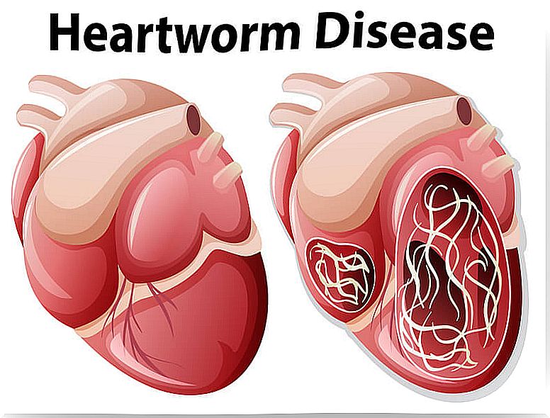 Heartworm disease